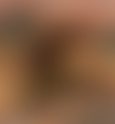 It’s essential to recognize that tinnitus is often not the only source of anxiety in someone’s life.