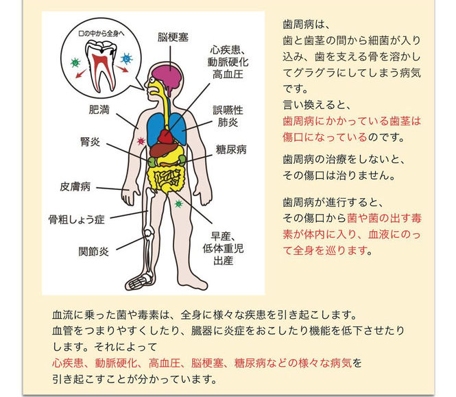 歯周病と全身疾患の関係