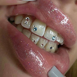 Tooth gems Novum Studio Rotterdam centrum