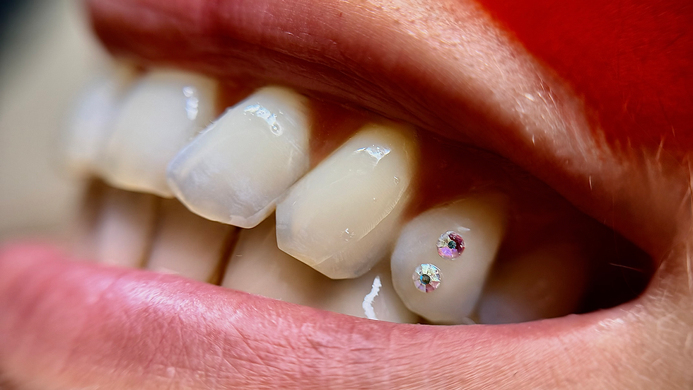 Mouth with a star tooth gem and a soft toothbrush in Rotterdam