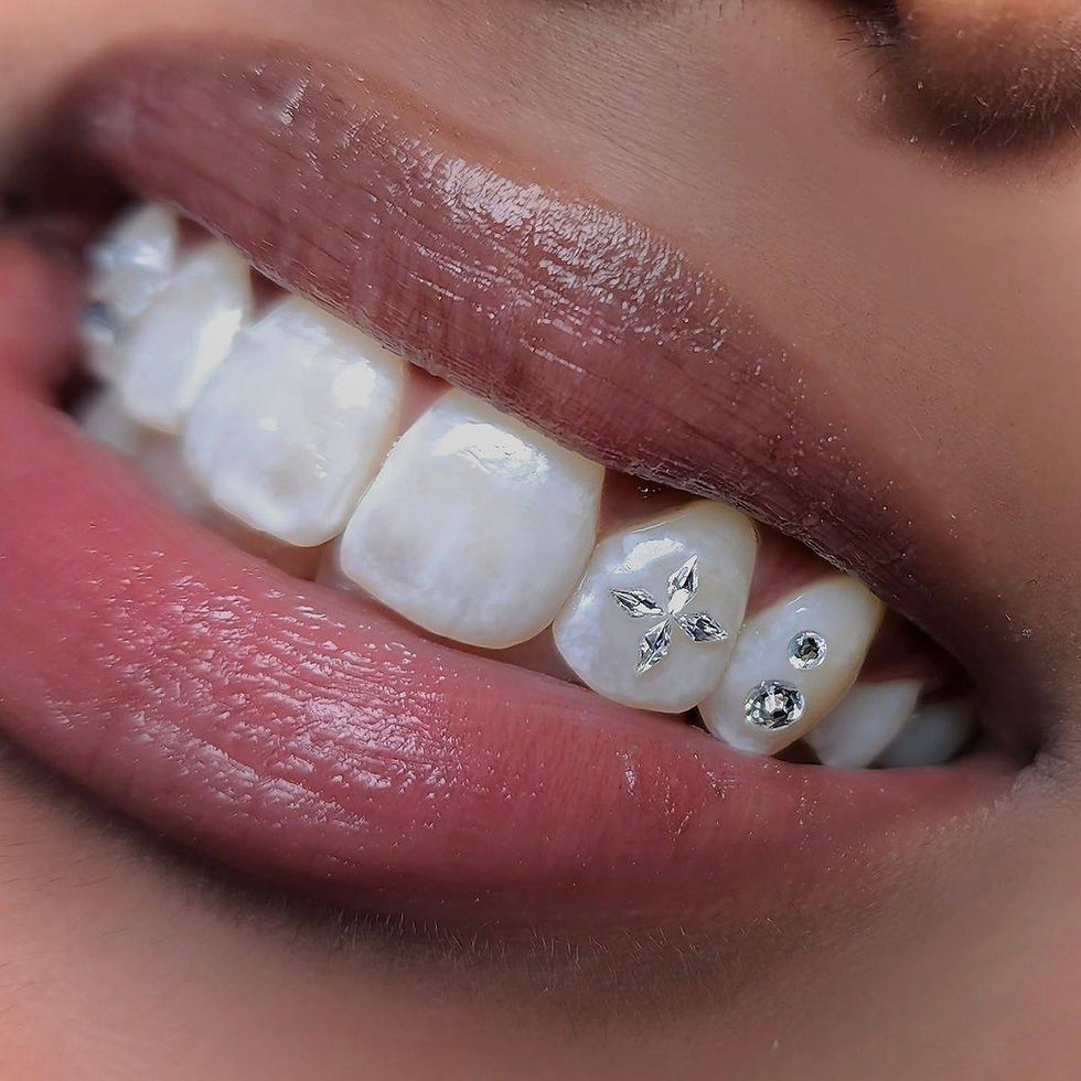 Wat zijn Icy Bar-tandjuwelen en wat is hun symboliek in moderne esthetische trends?