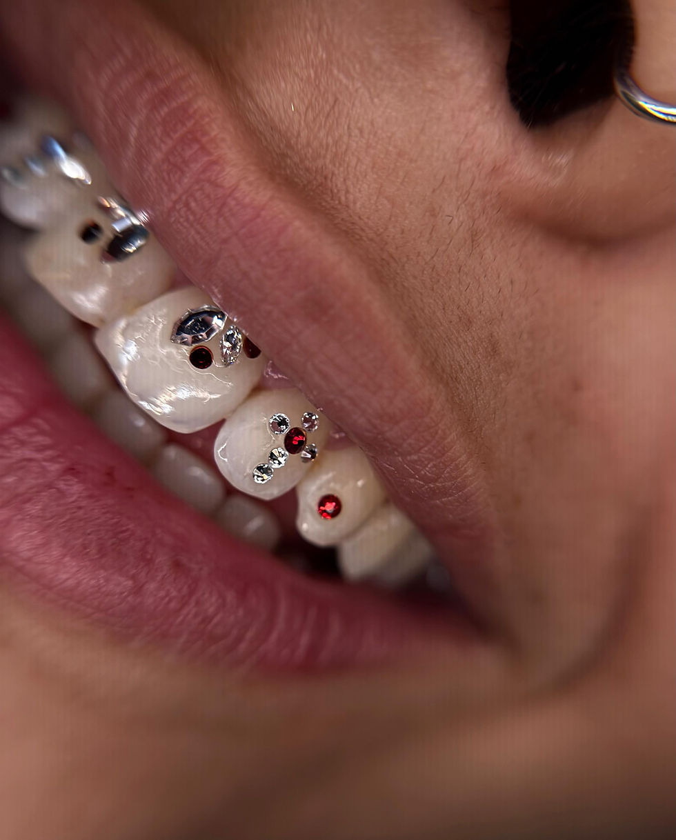 Understanding Tooth Gem Lifespan: How Long Do Tooth Gems Last?