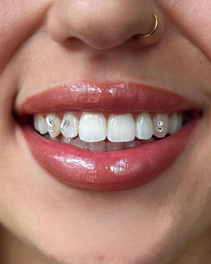 Close-up of a smiling mouth with small tooth gems.