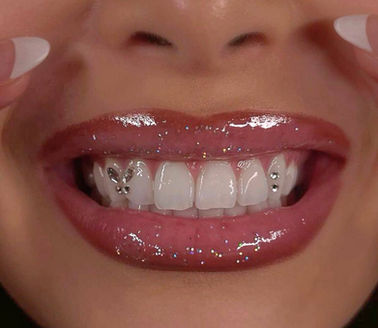 Close-up of a smile with butterfly tooth gems and gloss