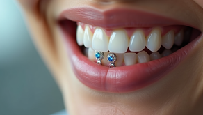 Summer Glow-Up Alert: 30% Korting op Alle Tooth Gem Designs bij Novum Studio Rotterdam