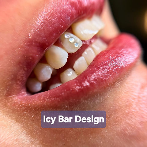 Icy Bar Tooth Gem Design.jpg