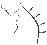 acupuncture-removebg-preview.png