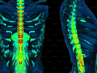 Your Back Doesn't Need to Be "Fixed" Structurally to Stop Hurting: Here's Why