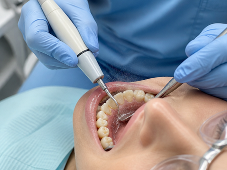 Professional Teeth Cleaning St. John's | Stavanger Dental