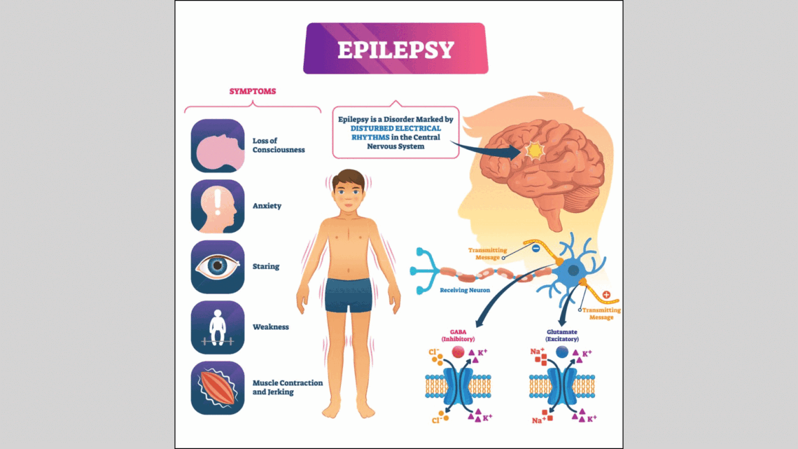 Epilepsy-1140x641.gif