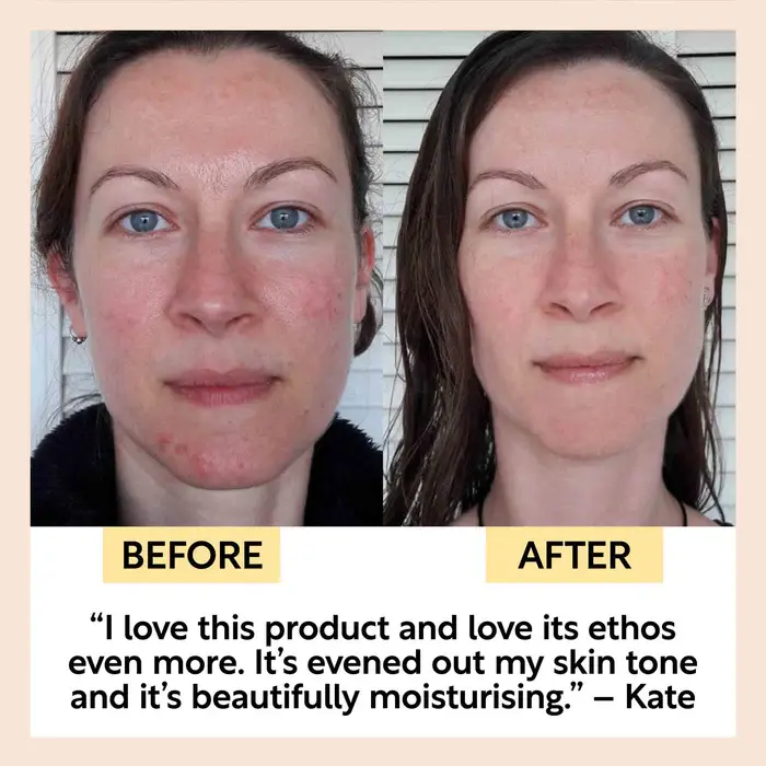 Thumbnail: Organic Face Oil with Coffee Extract