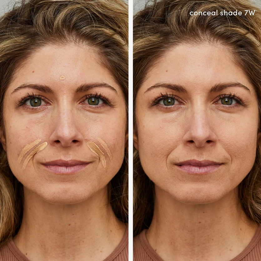 Thumbnail: A woman with a medium light skin tone showing before and after results.