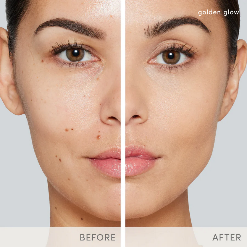 Thumbnail: A woman with a medium skin tone showing before and after results.