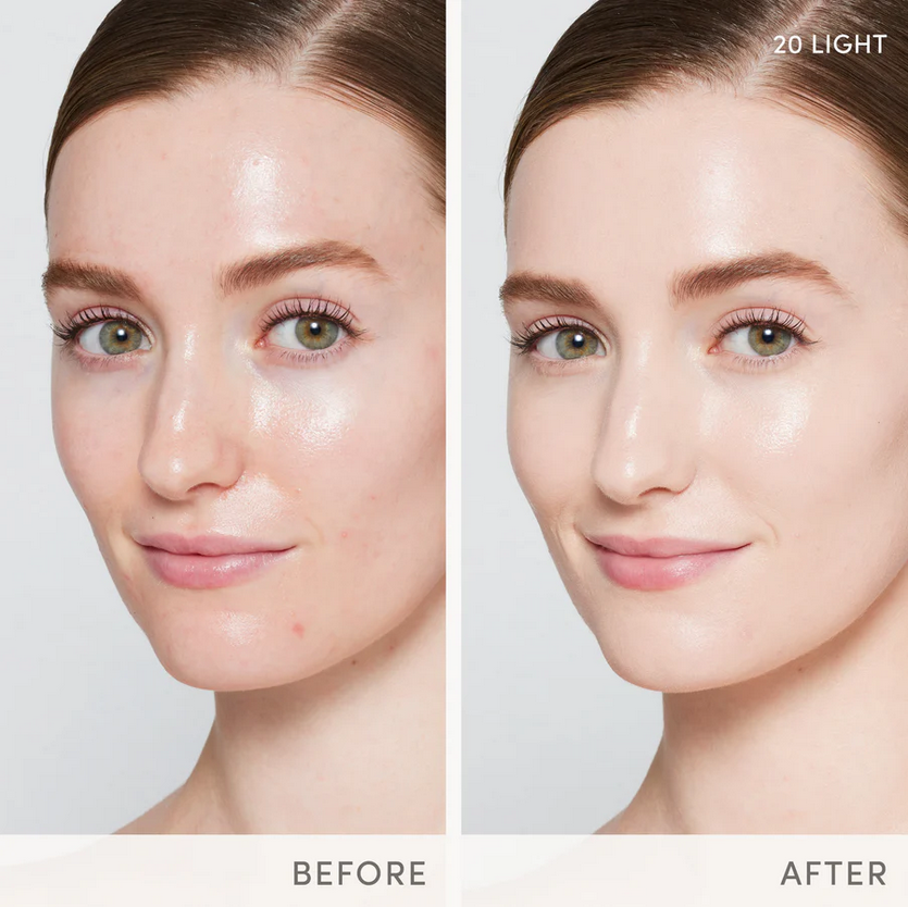 Thumbnail: A woman with fair skin showing before and after results.