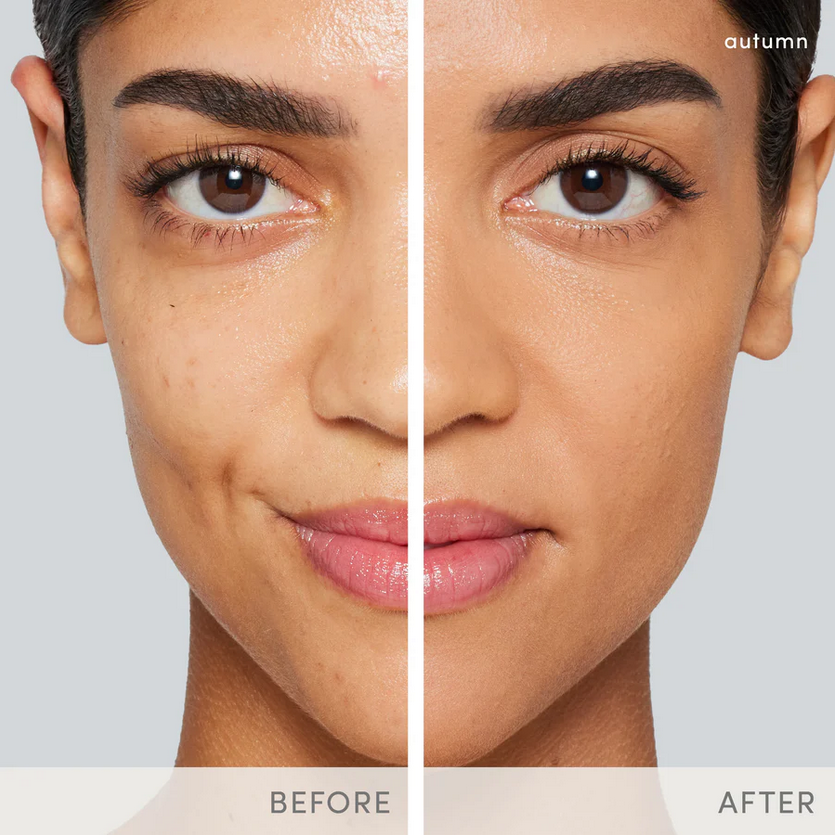Thumbnail: A woman with a medium dark skin tone showing before and after results.