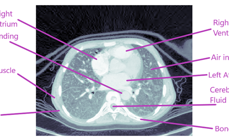 Interpretation of CT scan images: DICOM format