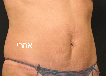 7.gif