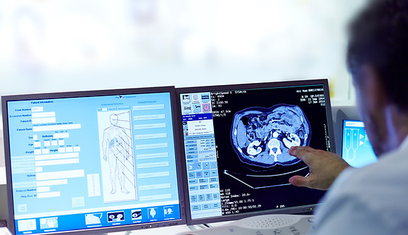 スキャンの分析