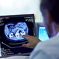 Doctor viewing CT scan