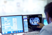 Analyzing Scans