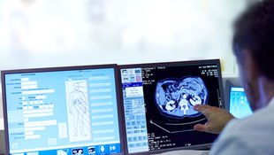 Performance management in UMC