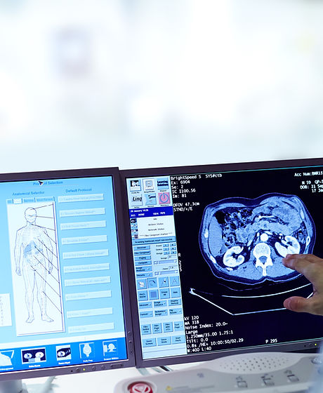 Analyzing Scans