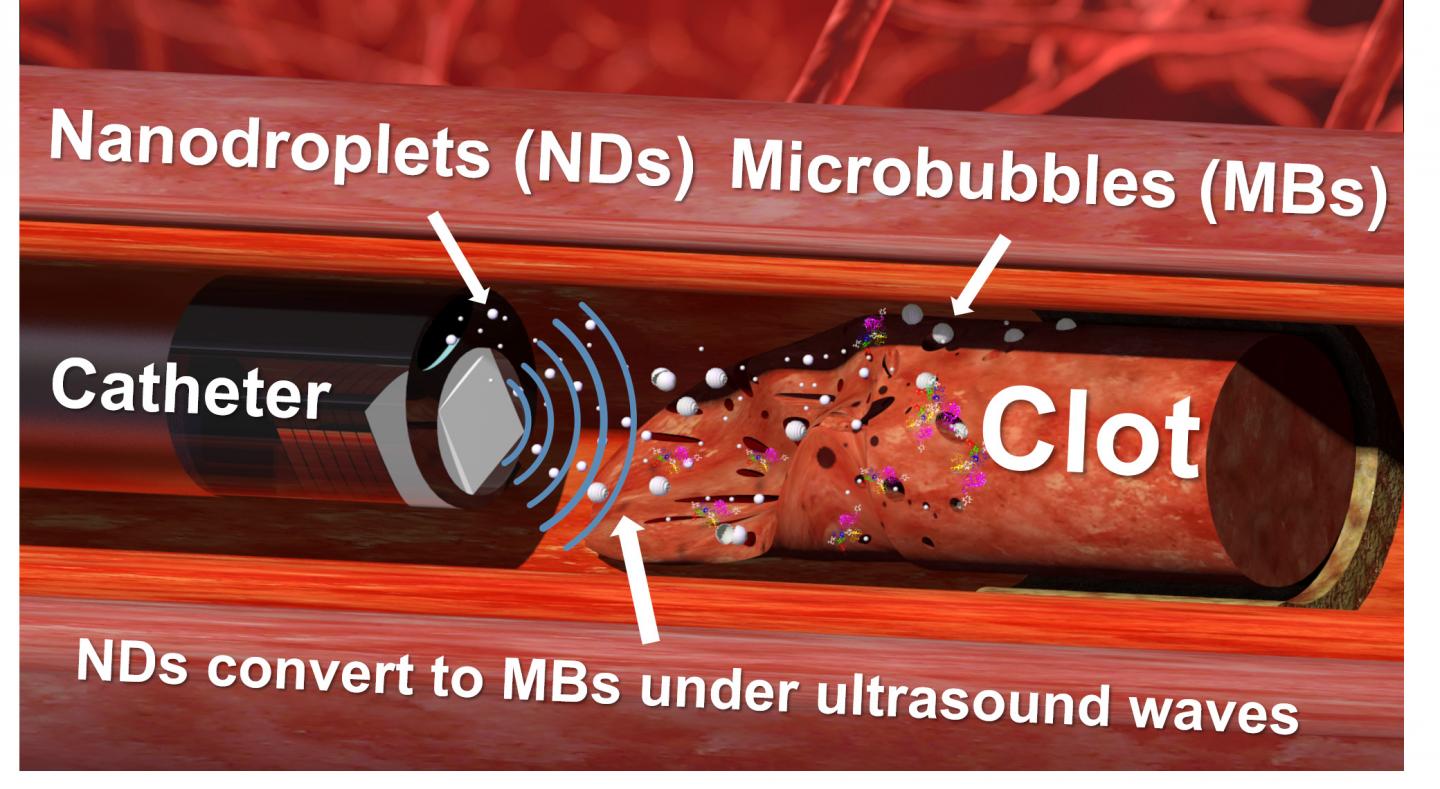The ultrasound causes the microbubbles to oscillate -- disrupting the clot's physical structure