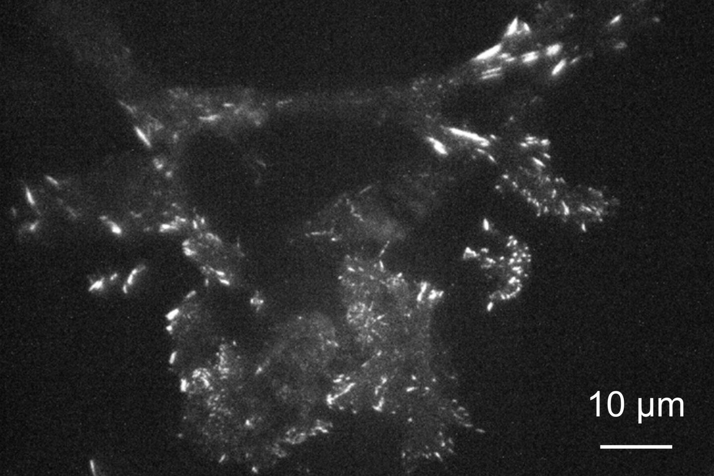 A mouse fibroblast cell imaged on a metasurface made of gold nanoparticles