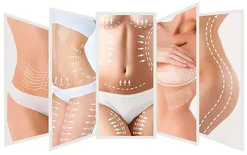 Body Contouring