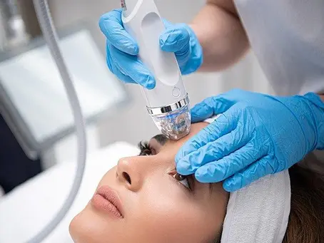 What Is RF Microneedling? The Secret to Smoother, Firmer Skin