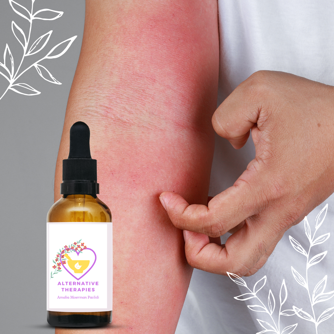 Bach Flower Mix for Dermatitis