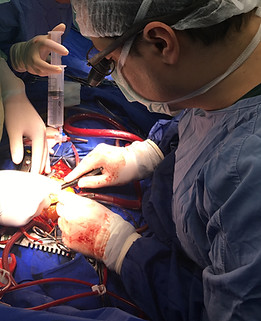 coronary bypass operation, CABG, koroner bypass ameliyatı