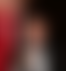 L'uso (eccessivo?) dei robot chirurgici. Intervista al Dr. Roberto Bertelli (*)