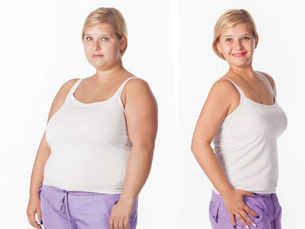 How Weight Loss Surgery Helps with Obesity-Related Conditions