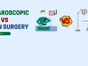 Laparoscopic Hernia Surgery Vs. Open Hernia Surgery – Which Is The Best?