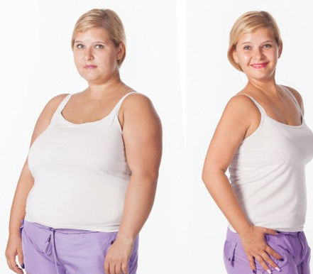 Weight loss surgery #COMSClinic.jpg