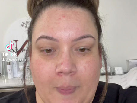 This happened to my skin after a week and 1/2 of NOT using my RN Skincare line 😲