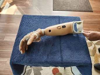 Right prosthetic arm