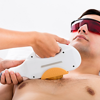 Depilação Masculina_torax.png
