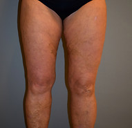 Brugger S OS STR 1 Kopie_edited.jpg