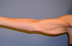 Rot R OA 1 Kopie_edited.jpg