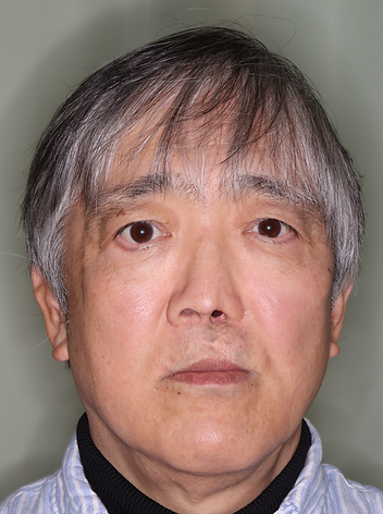 野村俊克術前シミュレーション正面.png