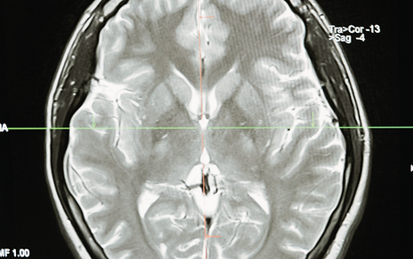 Imagerie médicale - Pexels