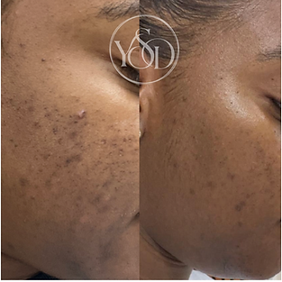 Beige Minimalist Skincare Before and After Instagram Post - 15.PNG