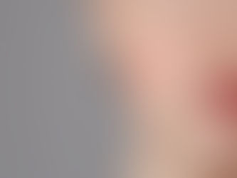 How To Calm Rosacea-Prone Skin?