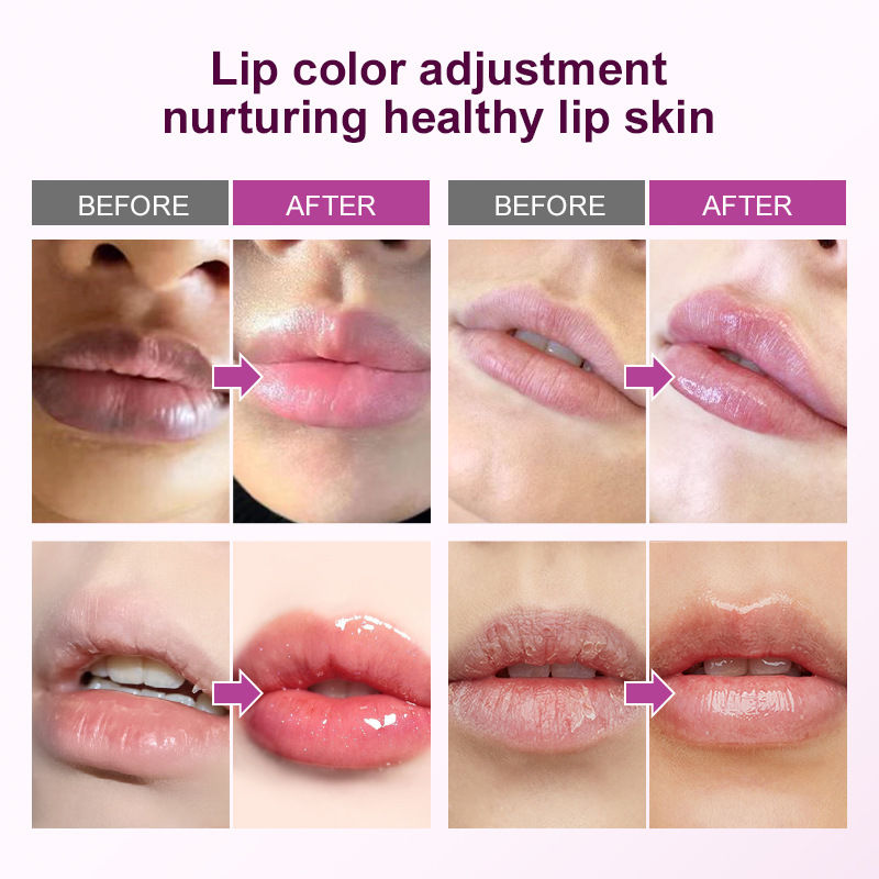 Miniatura: Remove Dark Lip Balm Fast Lightening Pink Lip Exfoliating Fade Lip Line Dead Ski