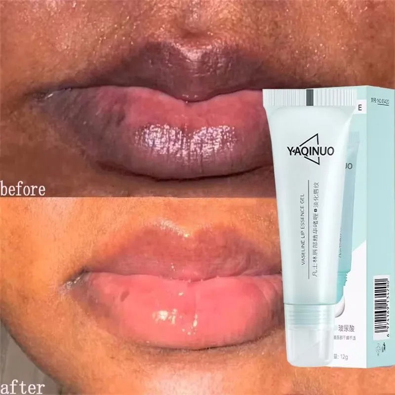 Miniatura: Remove Dark Lip Balm Fast Lightening Pink Lip Exfoliating Fade Lip Line Dead Ski