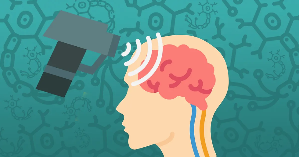Estimulação magnética transcraniana “theta-burst” e ineficaz para tratar depressão mista