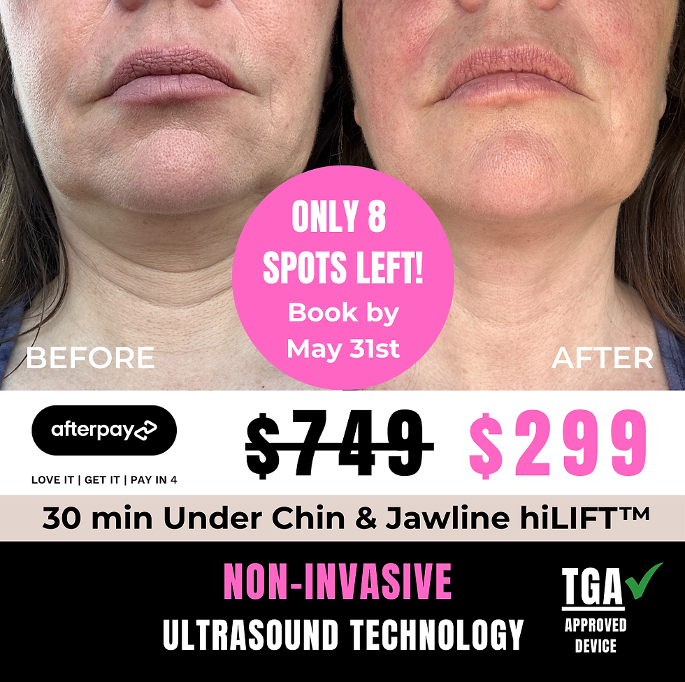 Facebook Ad Grok 1.png