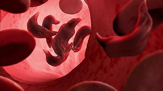 sicklecell2.jpg